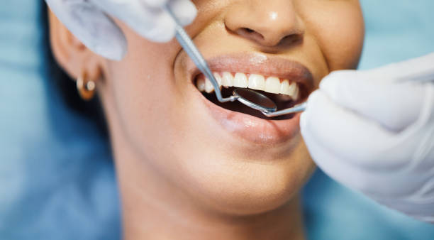 Best Emergency Dental Care for Sports Injuries in Macedonia, OH